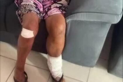 Reprodução de Imagem/MP